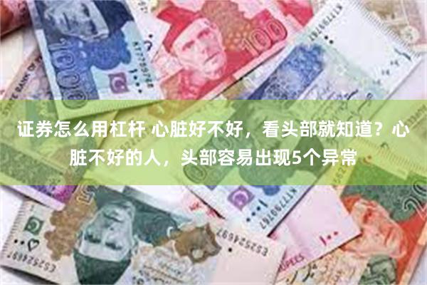 证券怎么用杠杆 心脏好不好，看头部就知道？心脏不好的人，头部容易出现5个异常